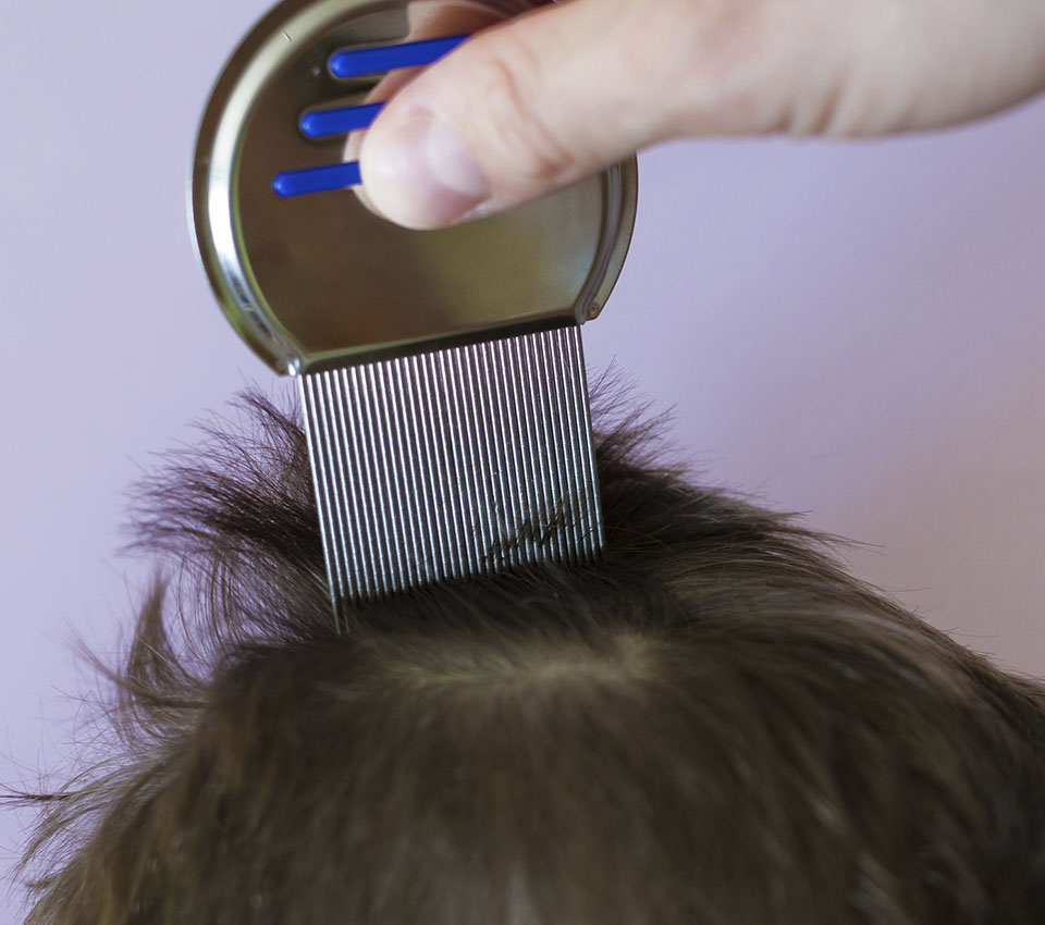 Innovación-en-pediculosis:-por-qué-ya-no-basta-con-eliminar-los-piojos