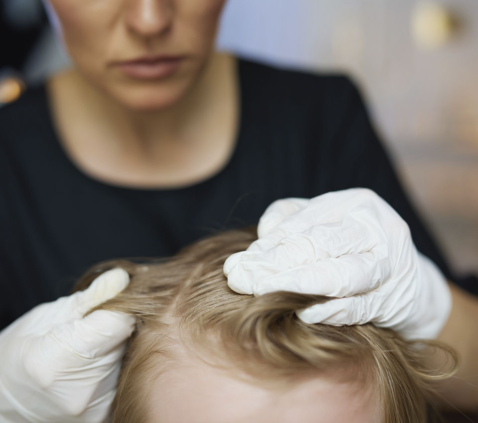 La-prevención-se-convierte-en-tendencia:-el-nuevo-enfoque-frente-a-los-piojos